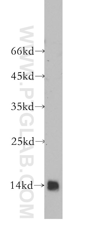 Western Blot (WB) analysis of PC-3 cells using GABARAPL2-Specific Polyclonal antibody (18724-1-AP)