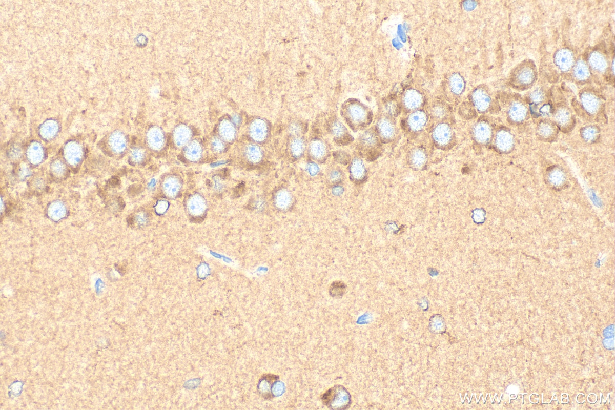 Immunohistochemistry (IHC) staining of rat brain tissue using GABA B receptor 1 Polyclonal antibody (13940-1-AP)