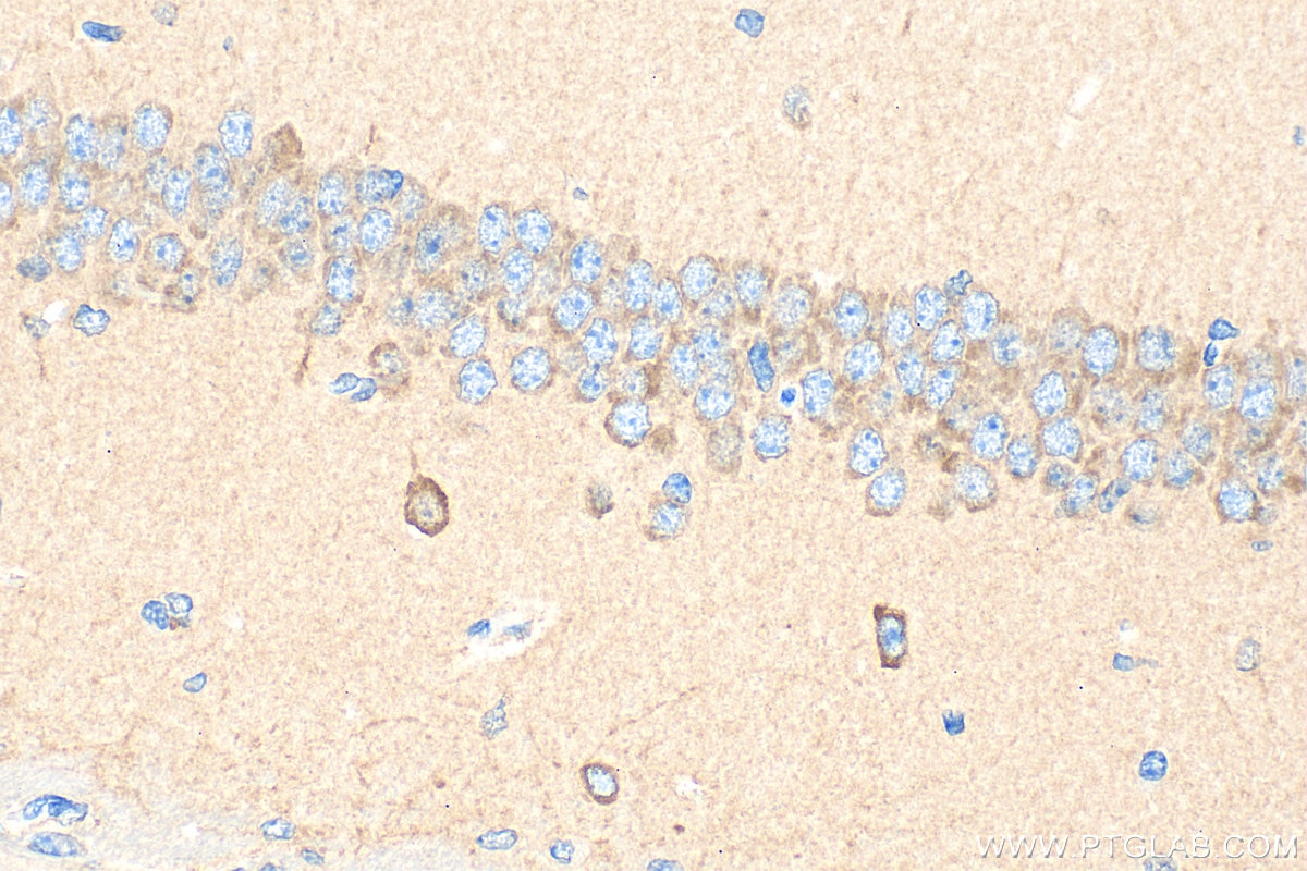 Immunohistochemistry (IHC) staining of mouse brain tissue using GABA B receptor 1 Polyclonal antibody (13940-1-AP)
