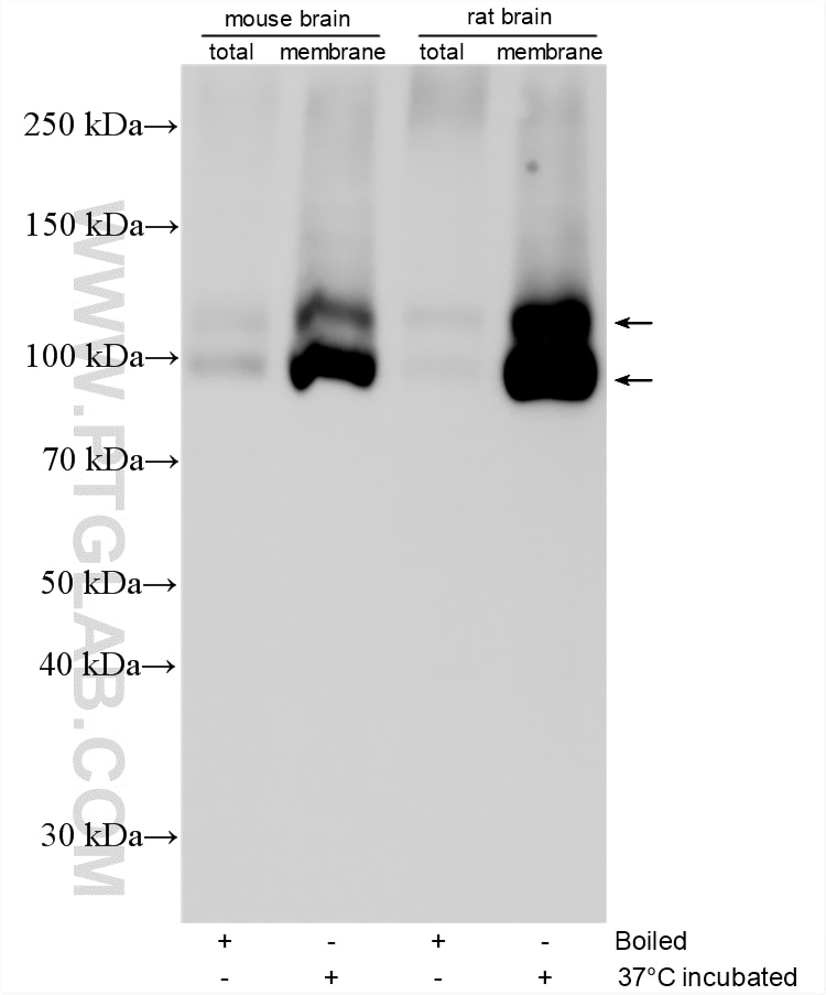 Western Blot (WB) analysis of various lysates using GABA B receptor 1 Polyclonal antibody (13940-1-AP)