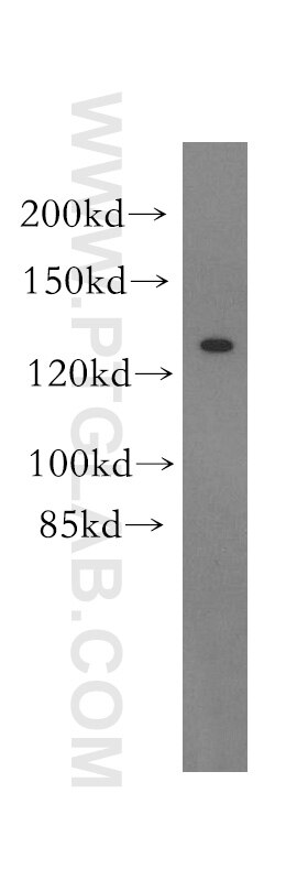 GABBR1 Polyclonal antibody