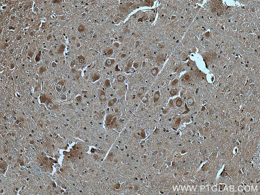 Immunohistochemistry (IHC) staining of mouse cerebellum tissue using GABBR2 Polyclonal antibody (27567-1-AP)