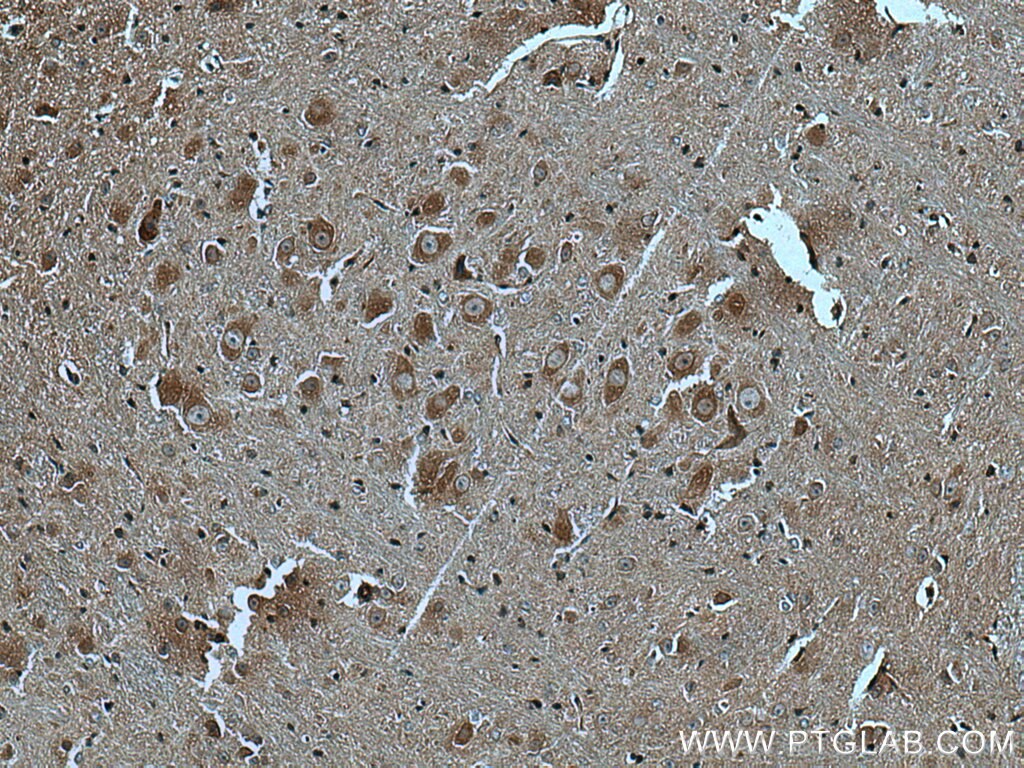 Immunohistochemistry (IHC) staining of mouse cerebellum tissue using GABBR2 Polyclonal antibody (27567-1-AP)