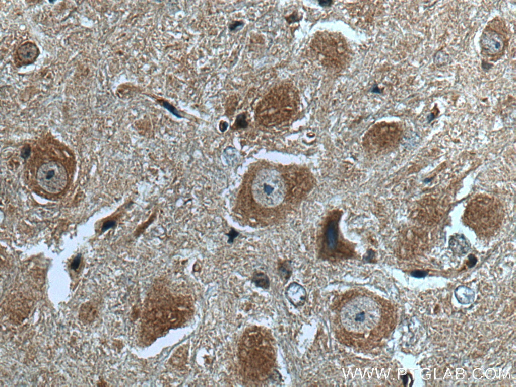 Immunohistochemistry (IHC) staining of mouse cerebellum tissue using GABBR2 Polyclonal antibody (27567-1-AP)