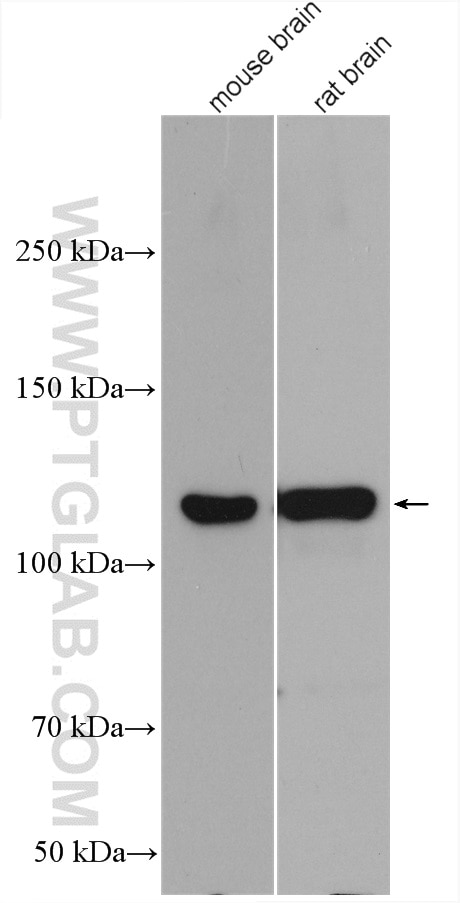 Western Blot (WB) analysis of various lysates using GABBR2 Polyclonal antibody (27567-1-AP)