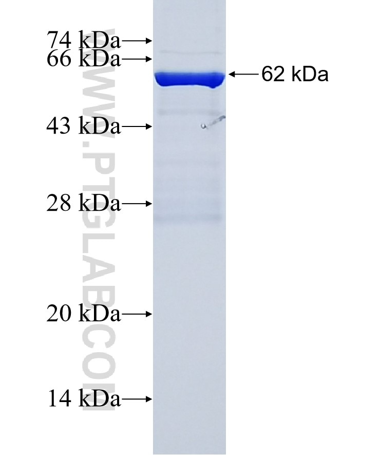 GABBR2 fusion protein Ag3661 SDS-PAGE