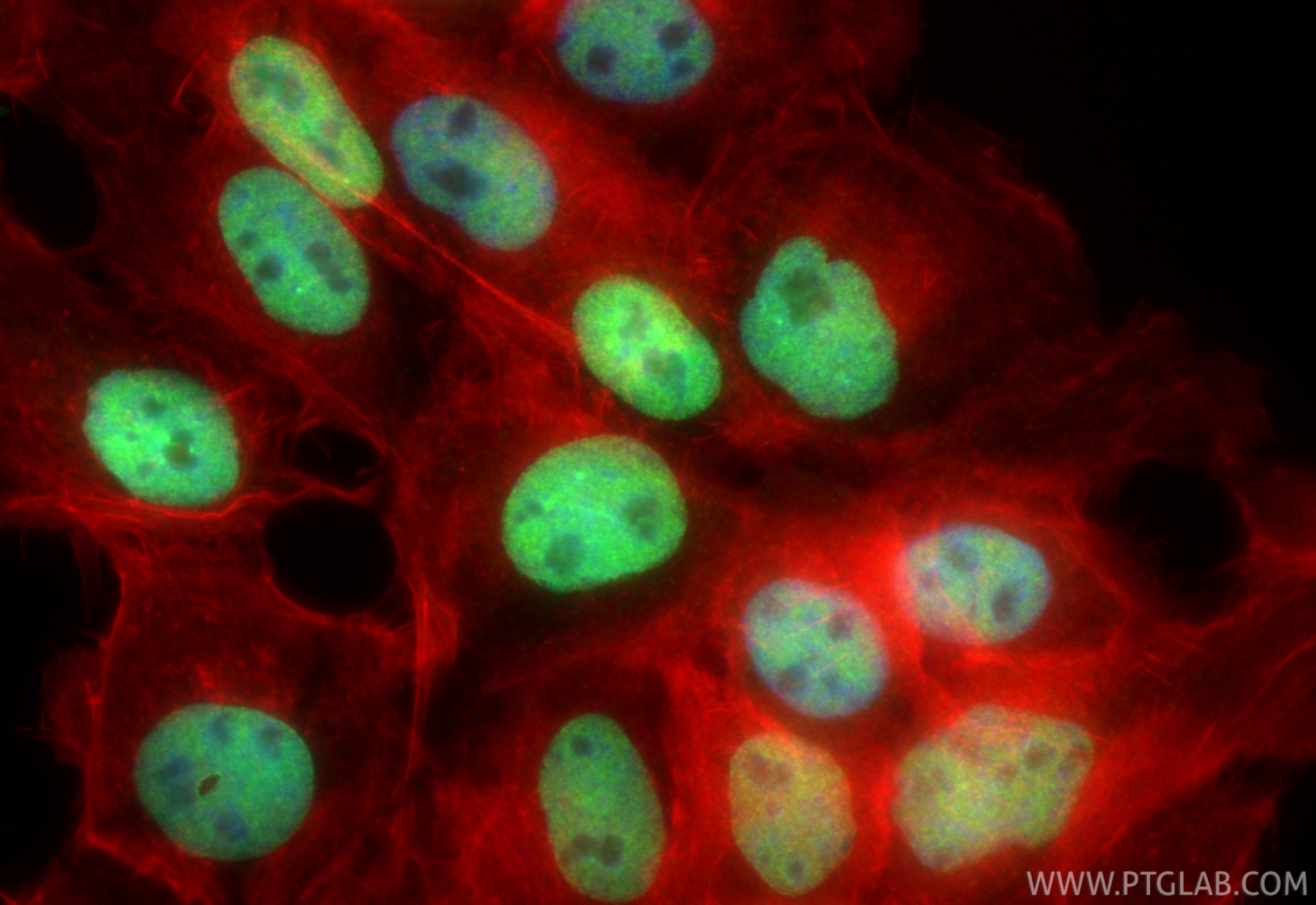 Immunofluorescence (IF) / fluorescent staining of A431 cells using GABPA Recombinant antibody (84951-4-RR)