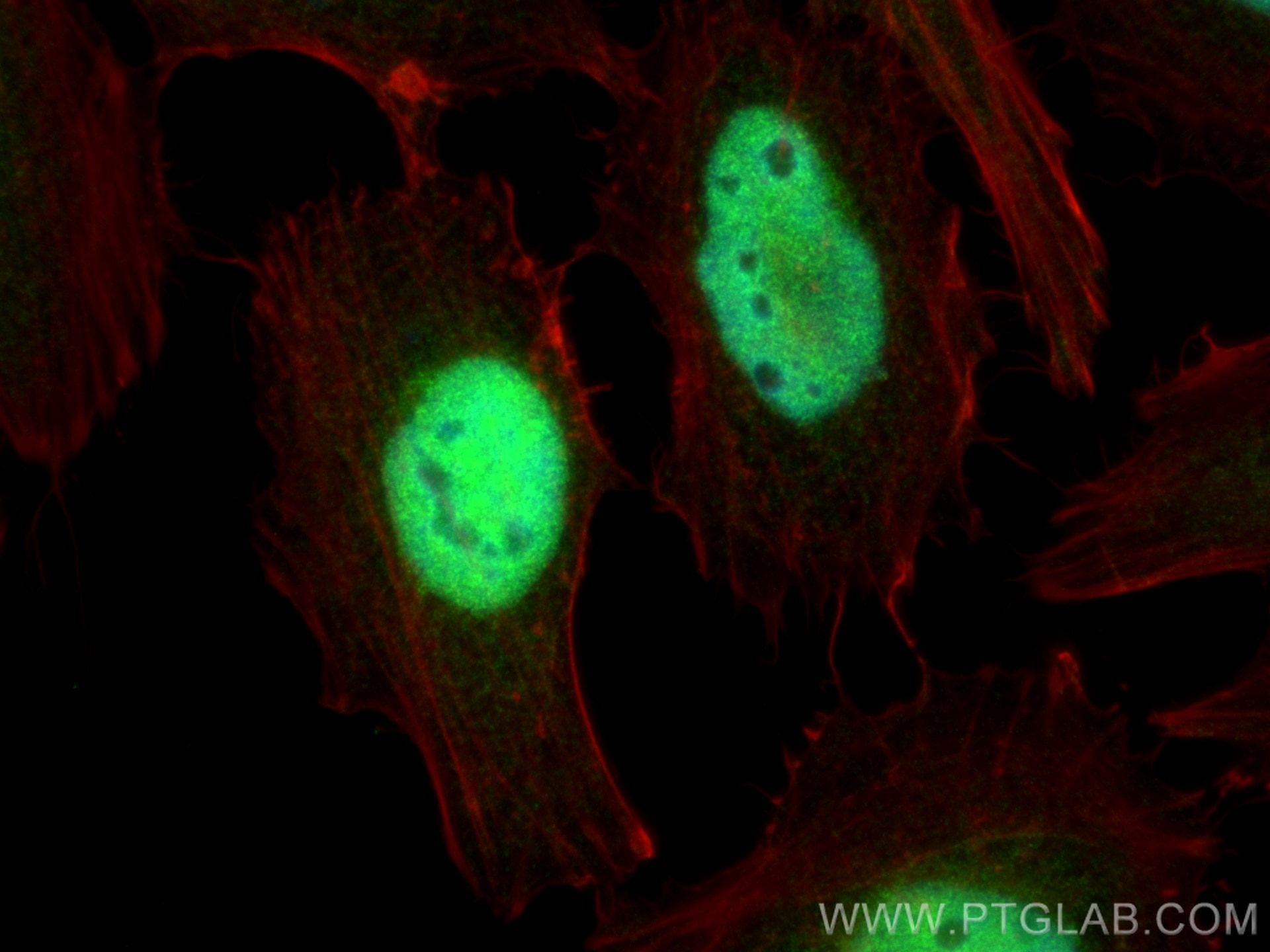 Immunofluorescence (IF) / fluorescent staining of HeLa cells using GABPB1 Polyclonal antibody (12597-1-AP)
