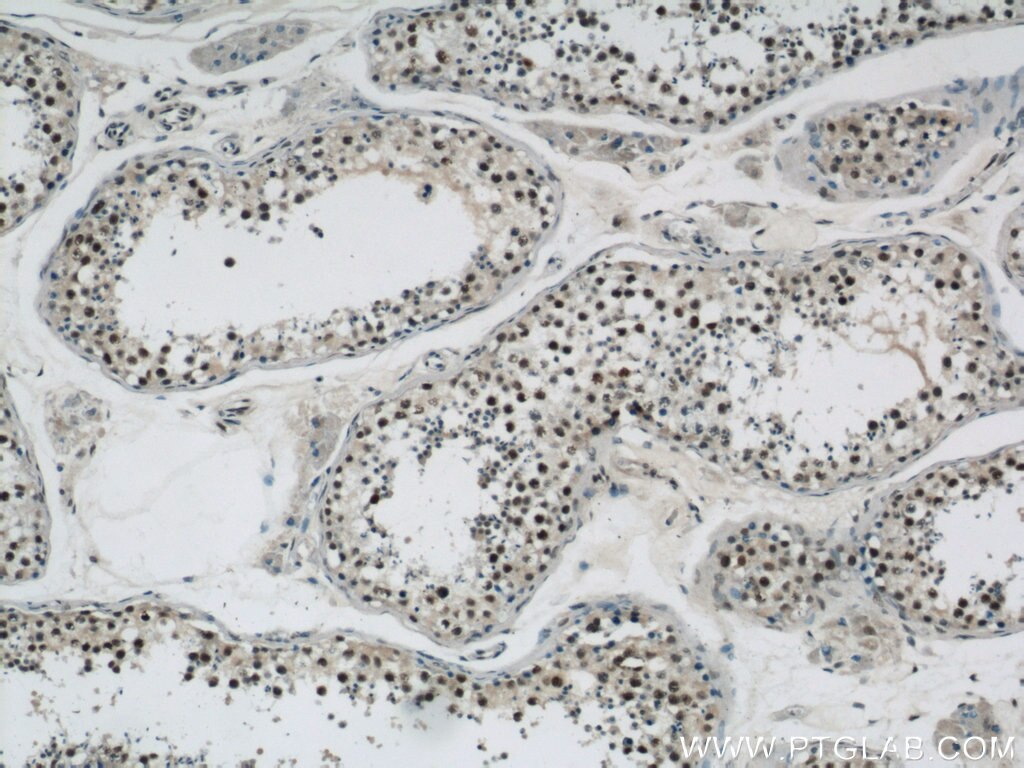 Immunohistochemistry (IHC) staining of human testis tissue using GABPB1 Polyclonal antibody (12597-1-AP)