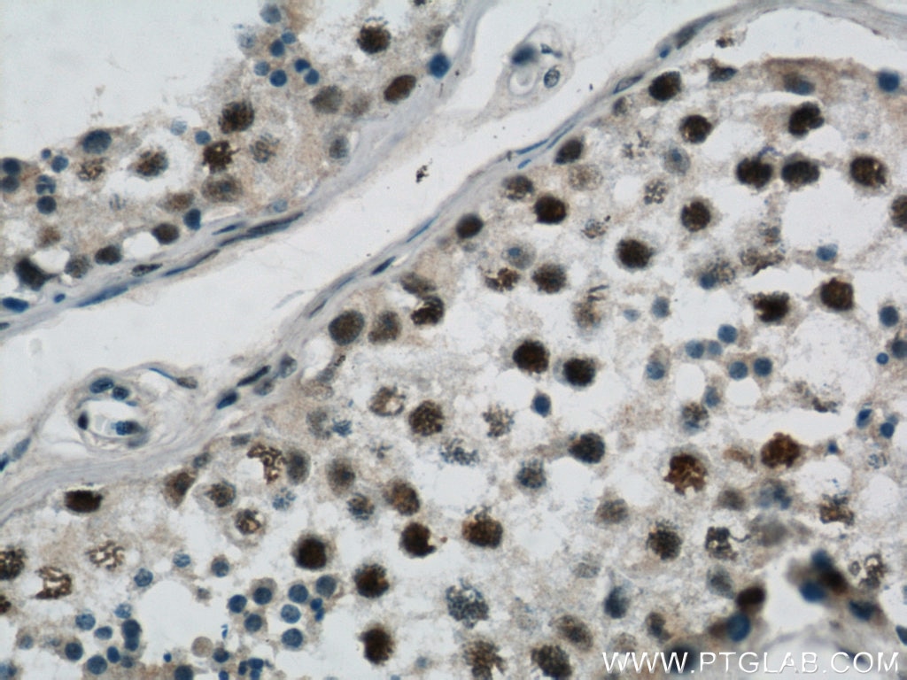 Immunohistochemistry (IHC) staining of human testis tissue using GABPB1 Polyclonal antibody (12597-1-AP)