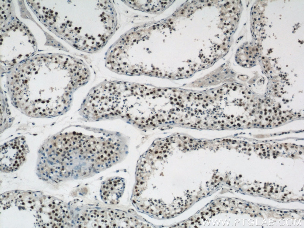 Immunohistochemistry (IHC) staining of human testis tissue using GABPB1 Polyclonal antibody (12597-1-AP)