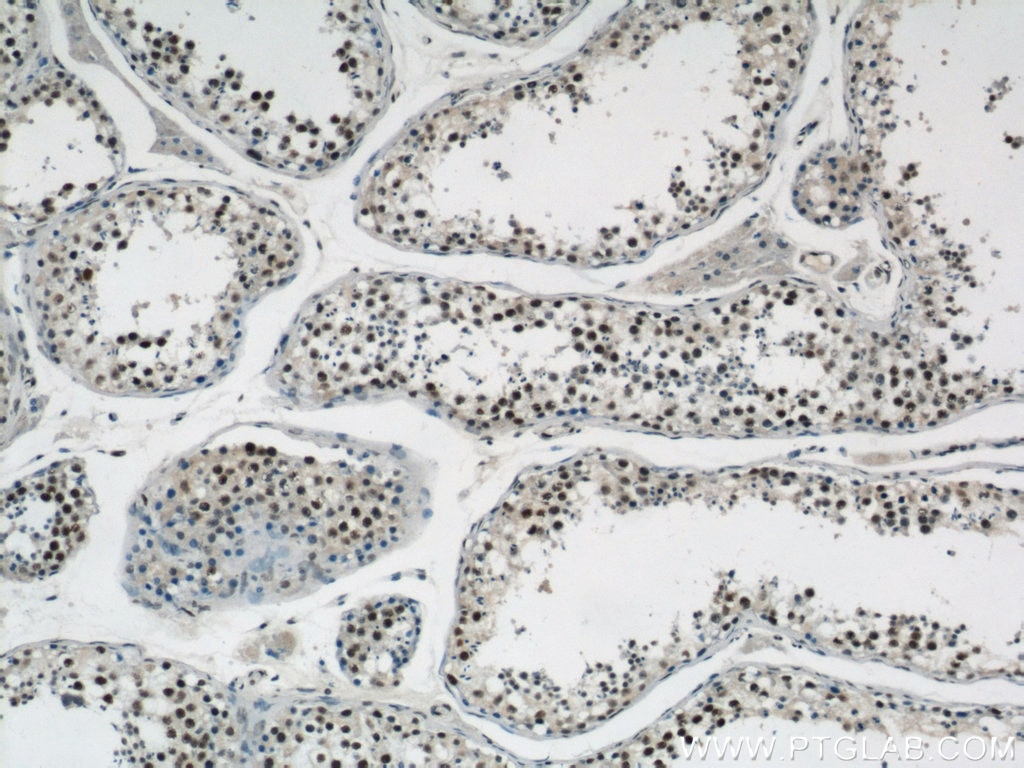 IHC staining of human testis using 12597-1-AP