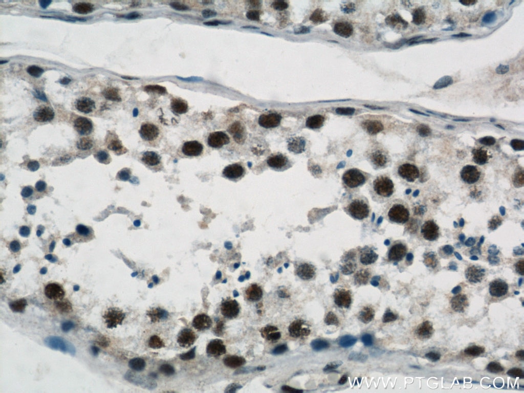 Immunohistochemistry (IHC) staining of human testis tissue using GABPB1 Polyclonal antibody (12597-1-AP)