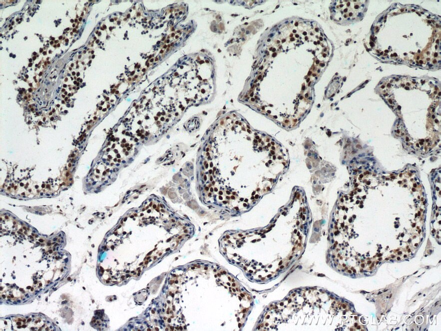 Immunohistochemistry (IHC) staining of human testis tissue using GABPB1 Polyclonal antibody (12597-1-AP)