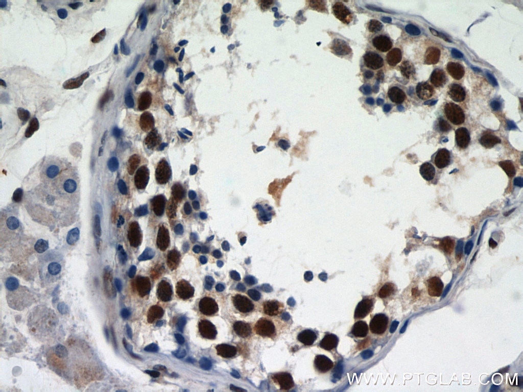 Immunohistochemistry (IHC) staining of human testis tissue using GABPB1 Polyclonal antibody (12597-1-AP)