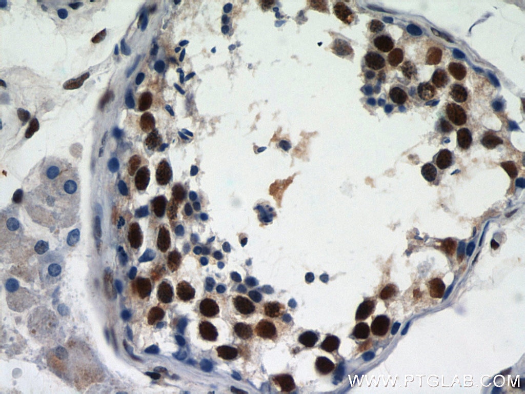 IHC staining of human testis using 12597-1-AP