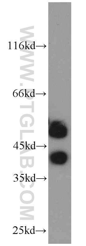 Western Blot (WB) analysis of HeLa cells using GABPB1 Polyclonal antibody (12597-1-AP)