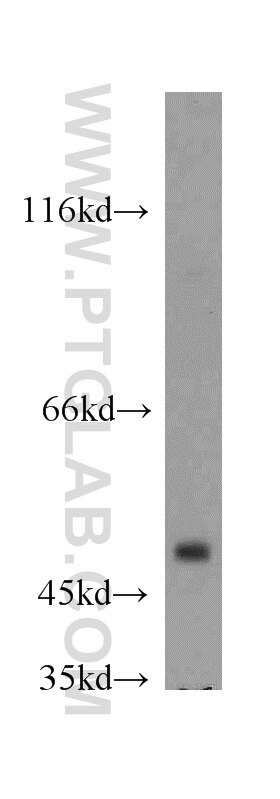 Western Blot (WB) analysis of Jurkat cells using GABPB2 Polyclonal antibody (20870-1-AP)