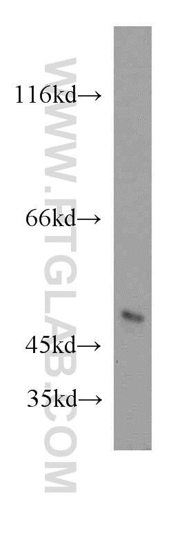 WB analysis of HeLa using 20870-1-AP