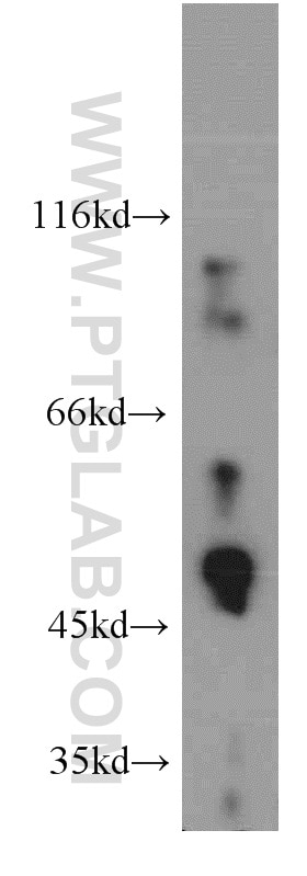 Western Blot (WB) analysis of HeLa cells using GABPB2 Polyclonal antibody (20870-1-AP)