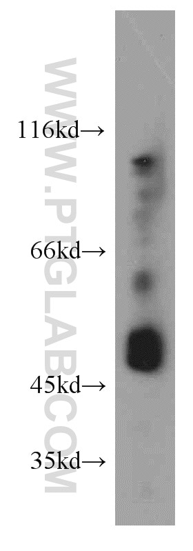 Western Blot (WB) analysis of A375 cells using GABPB2 Polyclonal antibody (20870-1-AP)