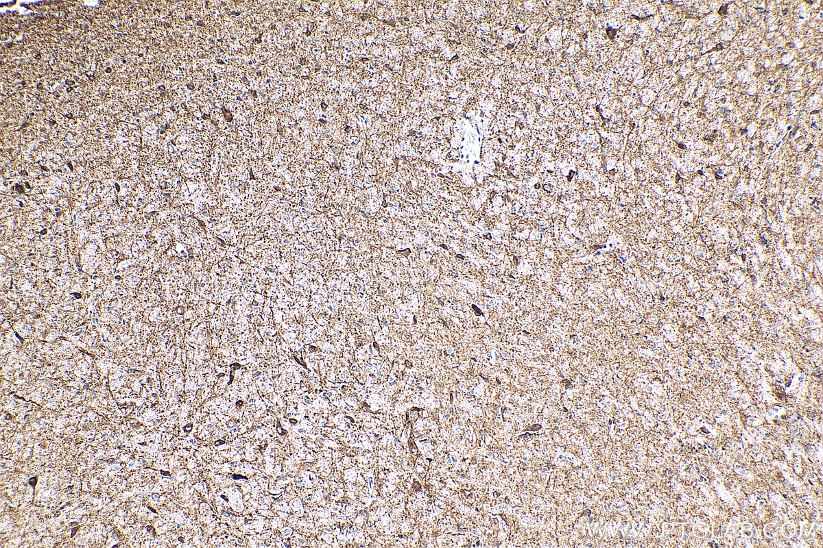 Immunohistochemistry (IHC) staining of rat brain tissue using GABRA1 Polyclonal antibody (12410-1-AP)