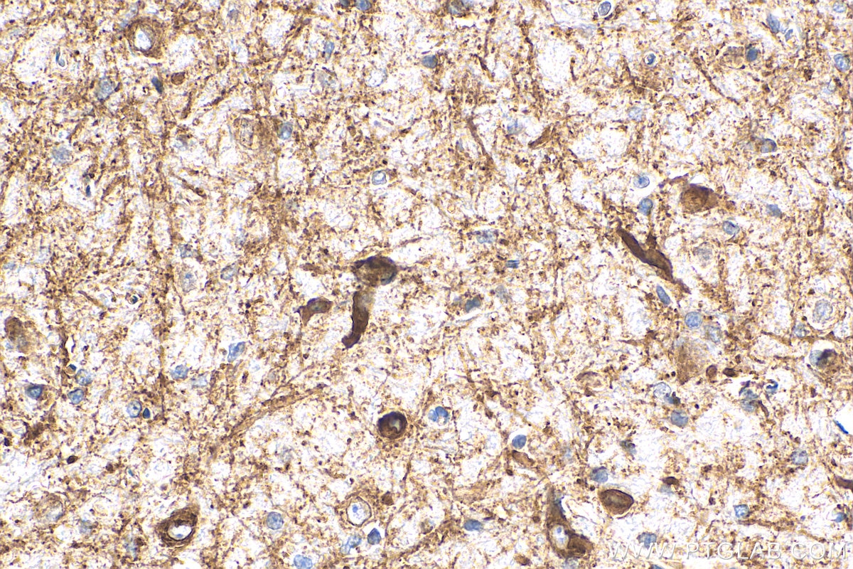 Immunohistochemistry (IHC) staining of rat brain tissue using GABRA1 Polyclonal antibody (12410-1-AP)