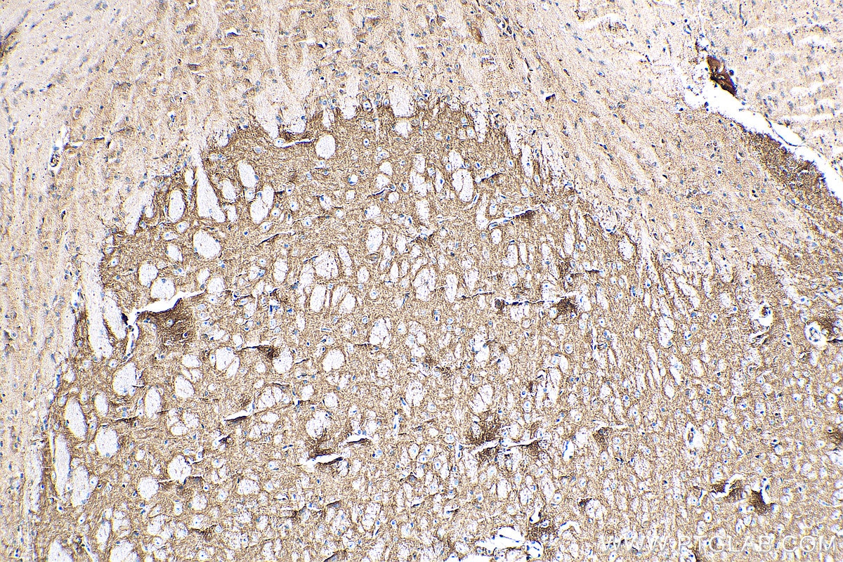 Immunohistochemistry (IHC) staining of mouse brain tissue using GABRA1 Polyclonal antibody (12410-1-AP)