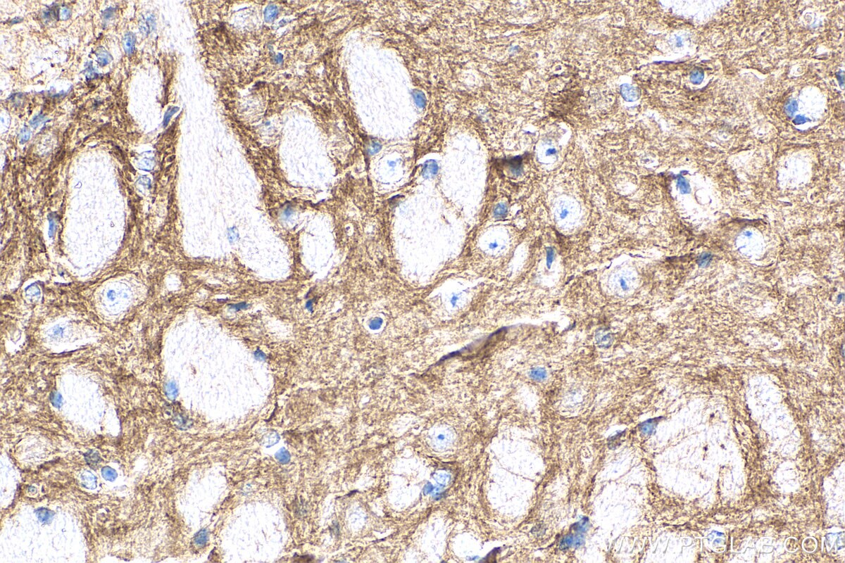 Immunohistochemistry (IHC) staining of mouse brain tissue using GABRA1 Polyclonal antibody (12410-1-AP)