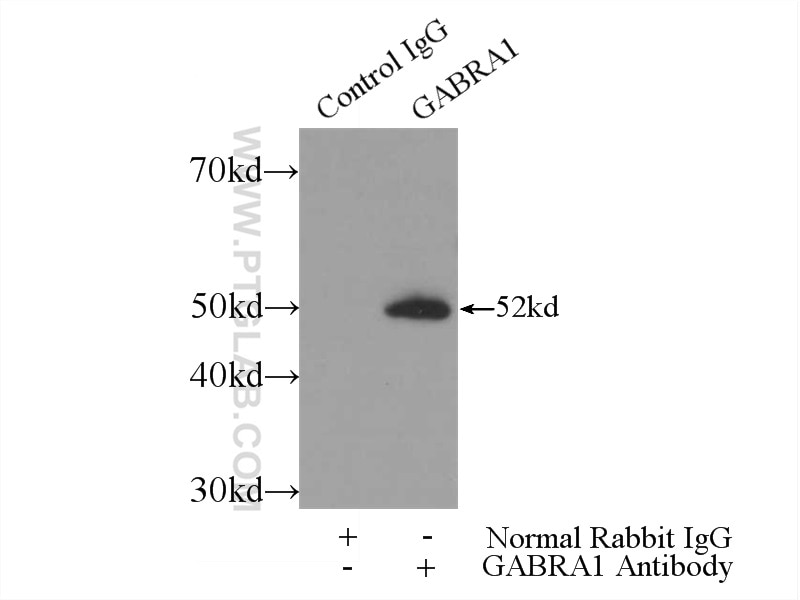 Immunoprecipitation (IP) experiment of mouse brain tissue using GABRA1 Polyclonal antibody (12410-1-AP)