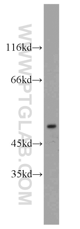 GABRA1 Polyclonal antibody