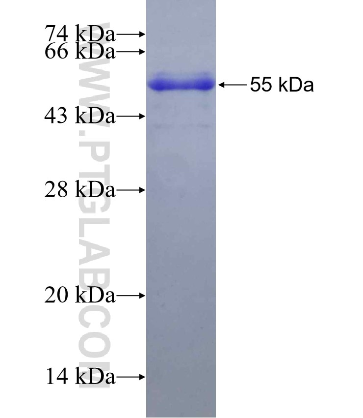 GABRA1 fusion protein Ag3117 SDS-PAGE