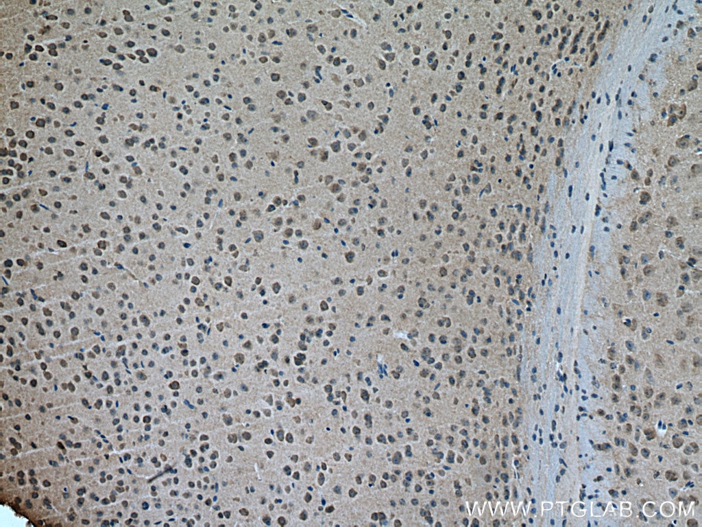 Immunohistochemistry (IHC) staining of mouse brain tissue using GABRA3 Polyclonal antibody (12708-1-AP)