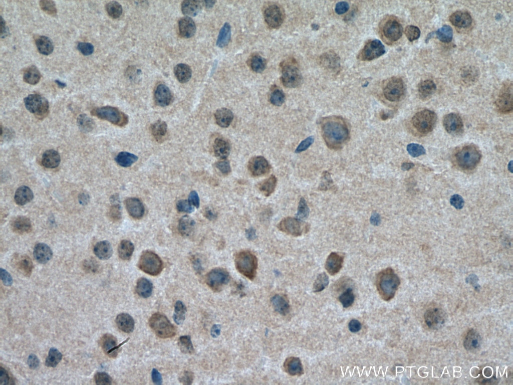 IHC staining of mouse brain using 12708-1-AP