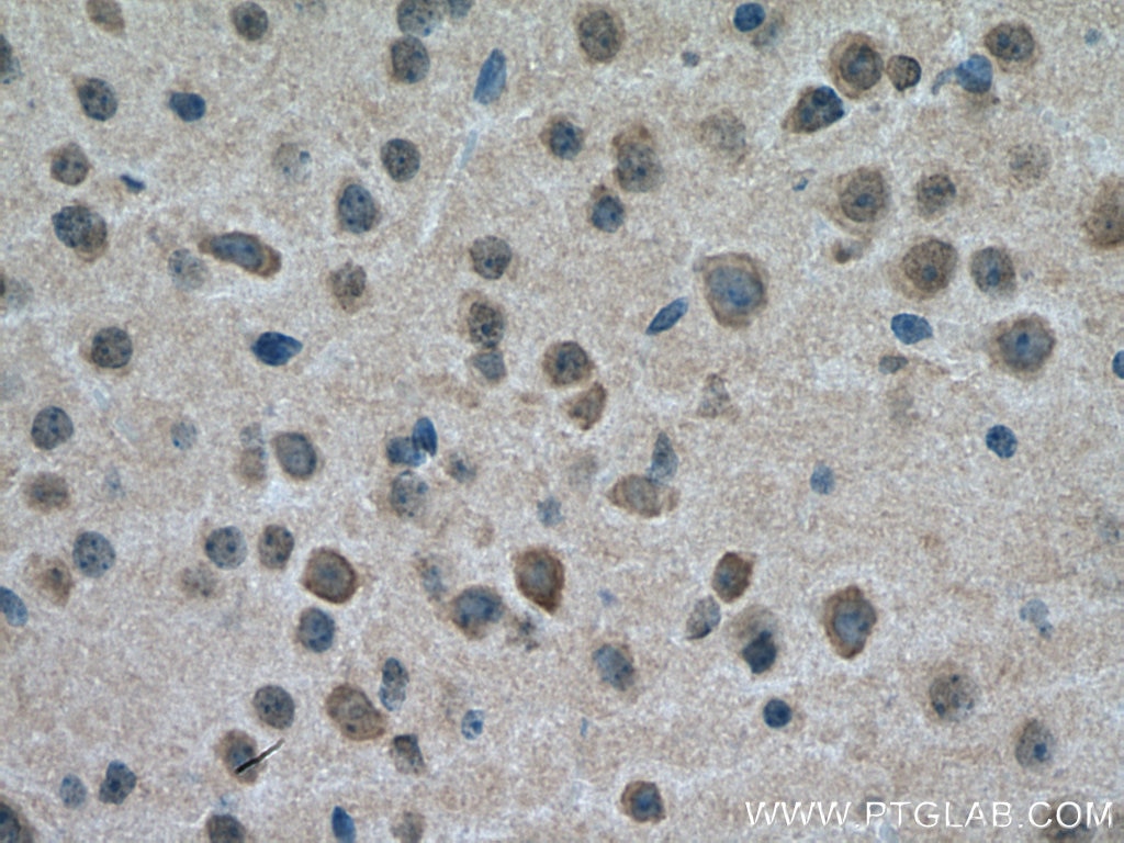 Immunohistochemistry (IHC) staining of mouse brain tissue using GABRA3 Polyclonal antibody (12708-1-AP)