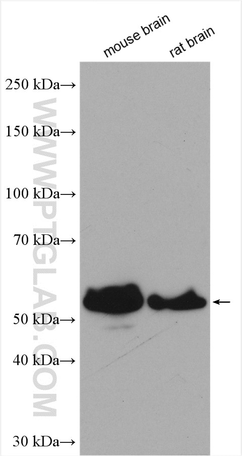 Western Blot (WB) analysis of various lysates using GABRA3 Polyclonal antibody (12708-1-AP)