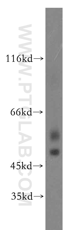 GABRA3 Polyclonal antibody