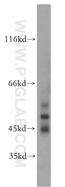 Western Blot (WB) analysis of rat brain tissue using GABRA3 Polyclonal antibody (12708-1-AP)