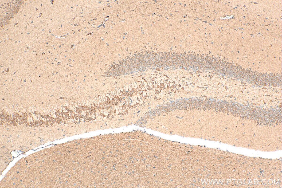 Immunohistochemical analysis of paraffin-embedded mouse brain tissue slide using 12979-1-AP (GABRA4 antibody) at dilution of 1:200 (under 10x lens). Heat mediated antigen retrieval with Tris-EDTA buffer (pH 9.0). Immunohistochemistry (IHC) staining of mouse brain tissue using GABRA4 Polyclonal antibody (12979-1-AP)