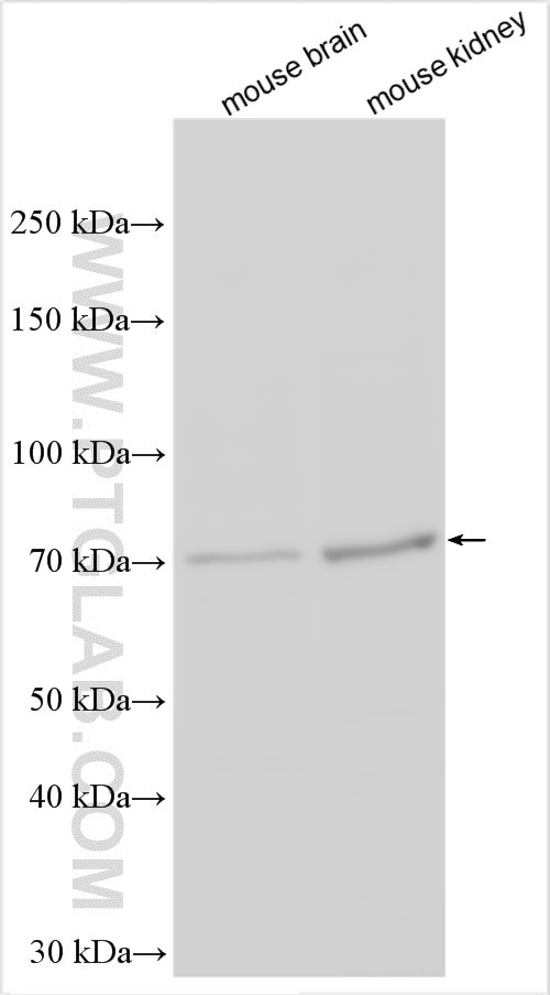 Western Blot (WB) analysis of various lysates using GABRA4 Polyclonal antibody (12979-1-AP)