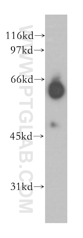 Western Blot (WB) analysis of human kidney tissue using GABRA4 Polyclonal antibody (12979-1-AP)