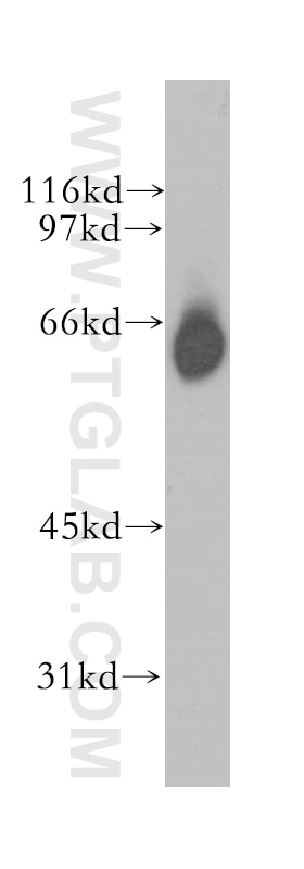 Western Blot (WB) analysis of mouse skeletal muscle tissue using GABRA4 Polyclonal antibody (12979-1-AP)