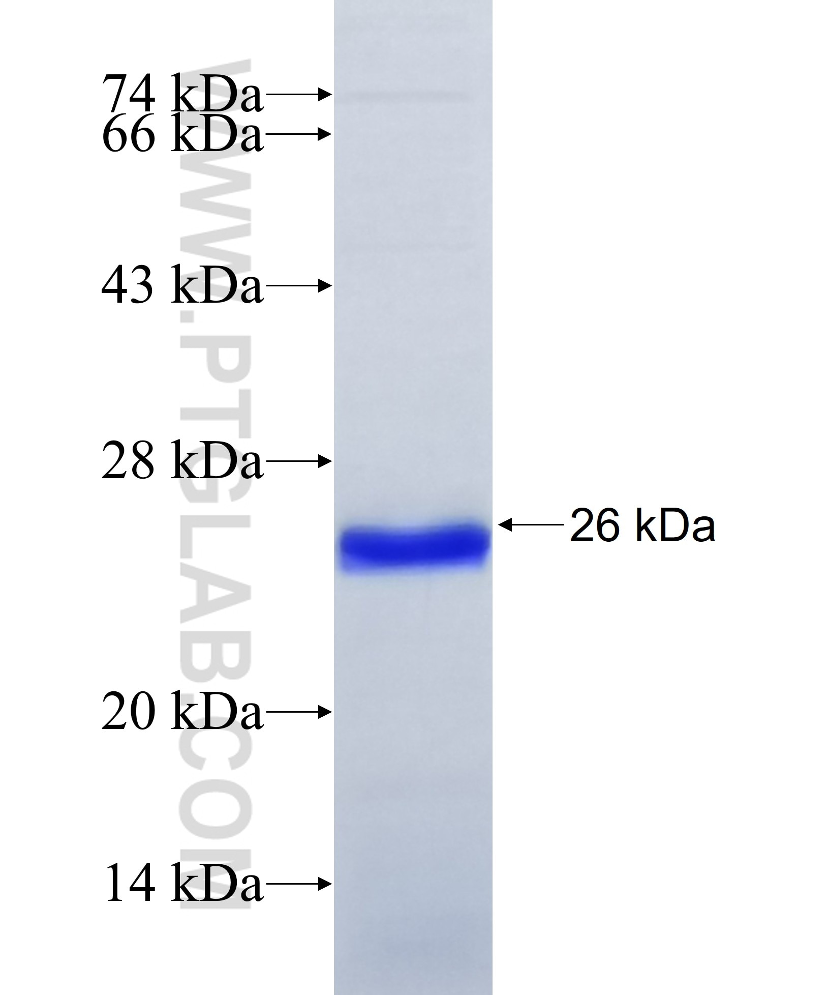 GABRA4 fusion protein Ag31581 SDS-PAGE GABRA4 fusion protein Ag31581 SDS-PAGE