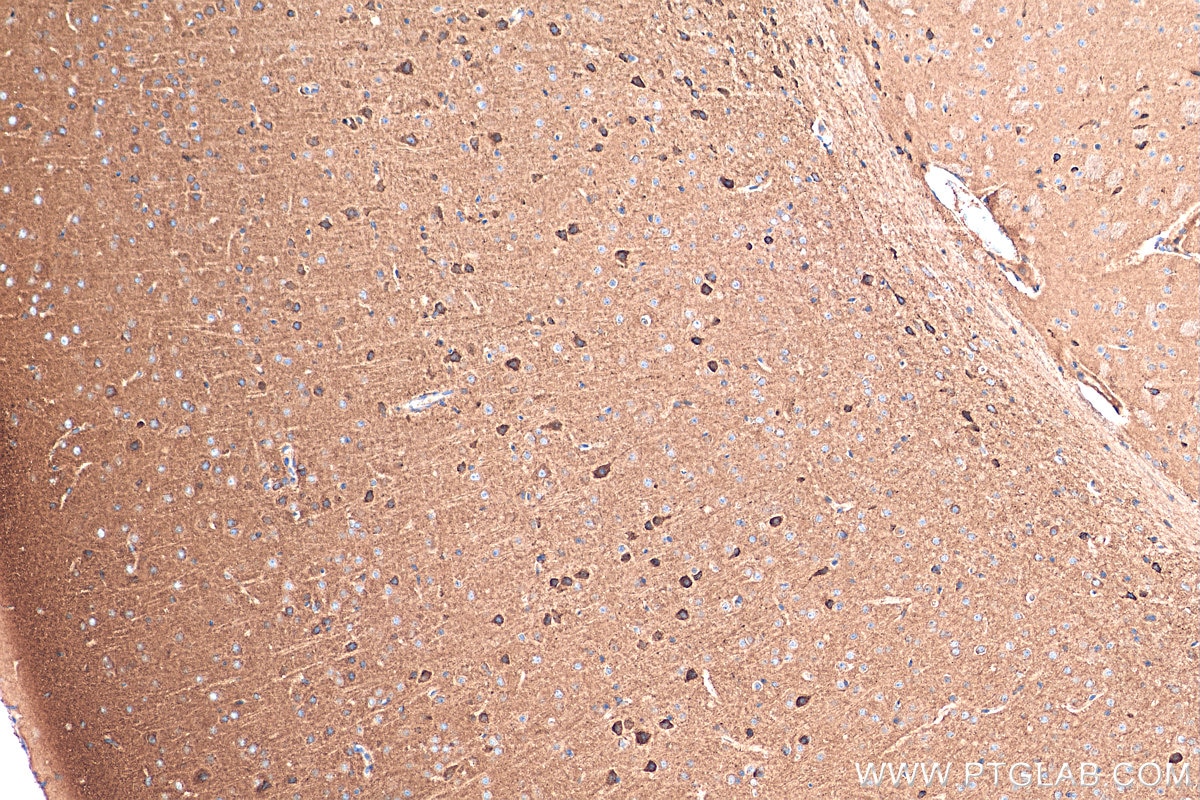 Immunohistochemistry (IHC) staining of mouse brain tissue using GABRA5 Polyclonal antibody (27929-1-AP)