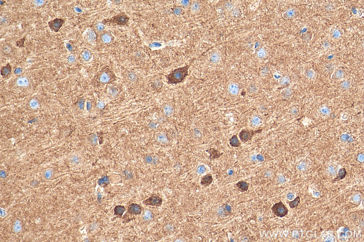 Immunohistochemistry (IHC) staining of mouse brain tissue using GABRA5 Polyclonal antibody (27929-1-AP)