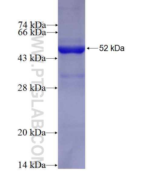 GABRA5 fusion protein Ag27376 SDS-PAGE