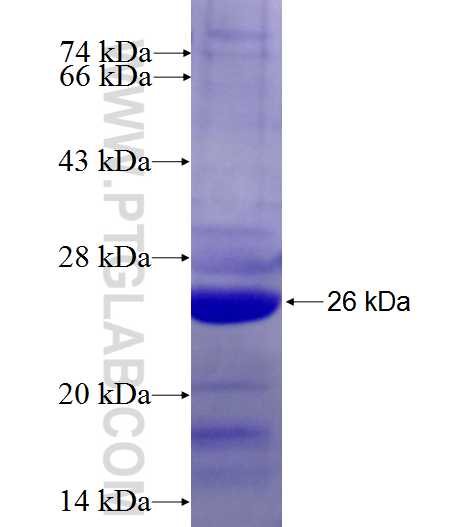 GABRA5 fusion protein Ag27441 SDS-PAGE