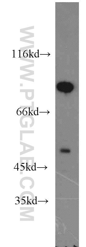 Western Blot (WB) analysis of mouse testis tissue using GABRB1 Polyclonal antibody (20183-1-AP)