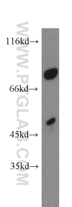 Western Blot (WB) analysis of mouse testis tissue using GABRB1 Polyclonal antibody (20183-1-AP)