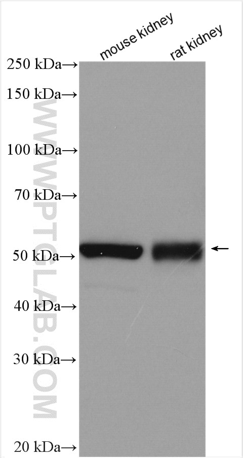 Western Blot (WB) analysis of various lysates using GABRD Polyclonal antibody (15623-1-AP)